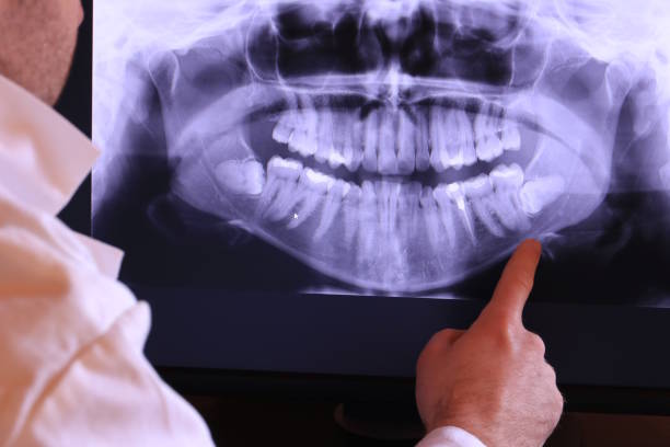 Best Root Canal Emergency Dentist  in Willacoochee, GA